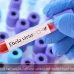 منظمة الصحة العالمية تؤكد انخفاض خطر انتقال فيروس إيبولا إلى مصر